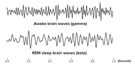 brain waves during rem are most similar to